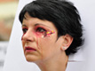 Blindness For "Beauty"